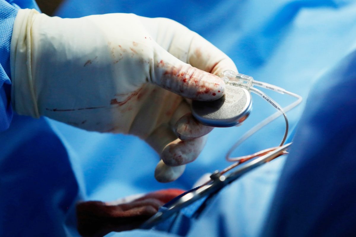 Zerada a fila de pacientes de marca-passo do Base