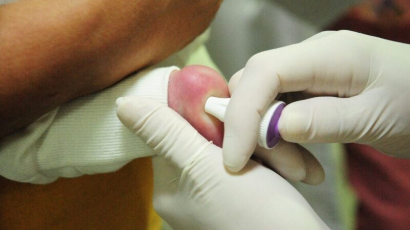 Teste do pezinho feito no DF é o mais completo do país